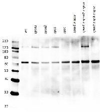 SPSC | Sucrose phosphate synthase isoform C in the group Antibodies Plant/Algal / Photosynthesis / Sucrose metabolism at Agrisera AB (Antibodies for research) (AS15 2997)